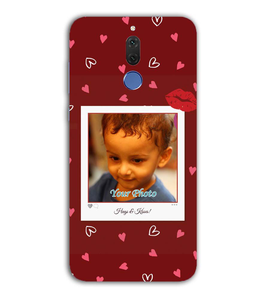 A0502-Hugs n Kisses Back Cover for Huawei Nova 2i