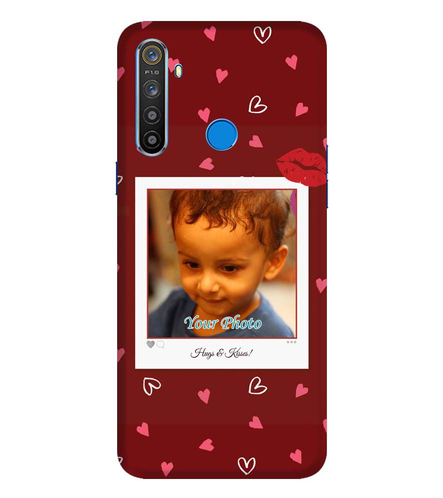 A0502-Hugs n Kisses Back Cover for Realme Narzo 10