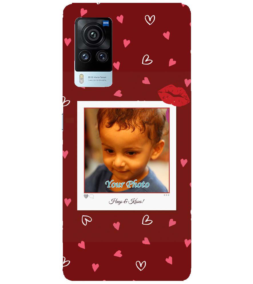 A0502-Hugs n Kisses Back Cover for vivo X60 Pro
