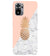 PS1330-Pineapple Marble Back Cover for Xiaomi Redmi Note 10